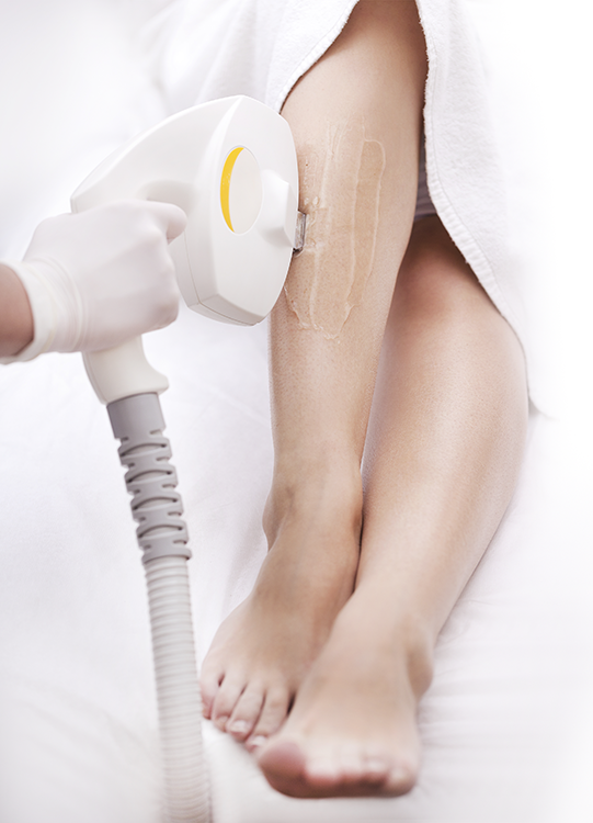 Laser_hair_removal_01