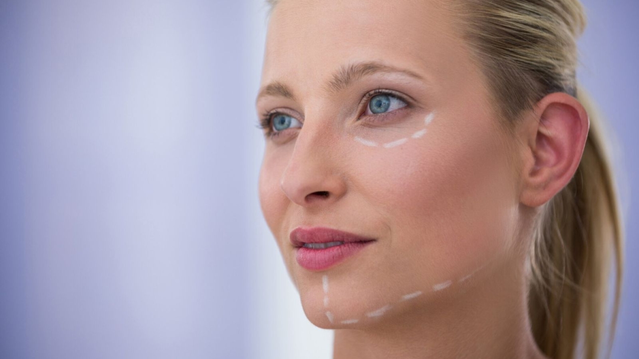 Facial Contouring with Fillers