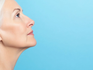 Nasolabial Folds - Should We Stop Smiling