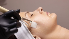 Chemical Peels - How to Achieve Fresh and Youthful Skin