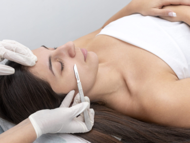A closeup of the doctor with a scalpel treating the woman's skin. Dermaplaning treatment.