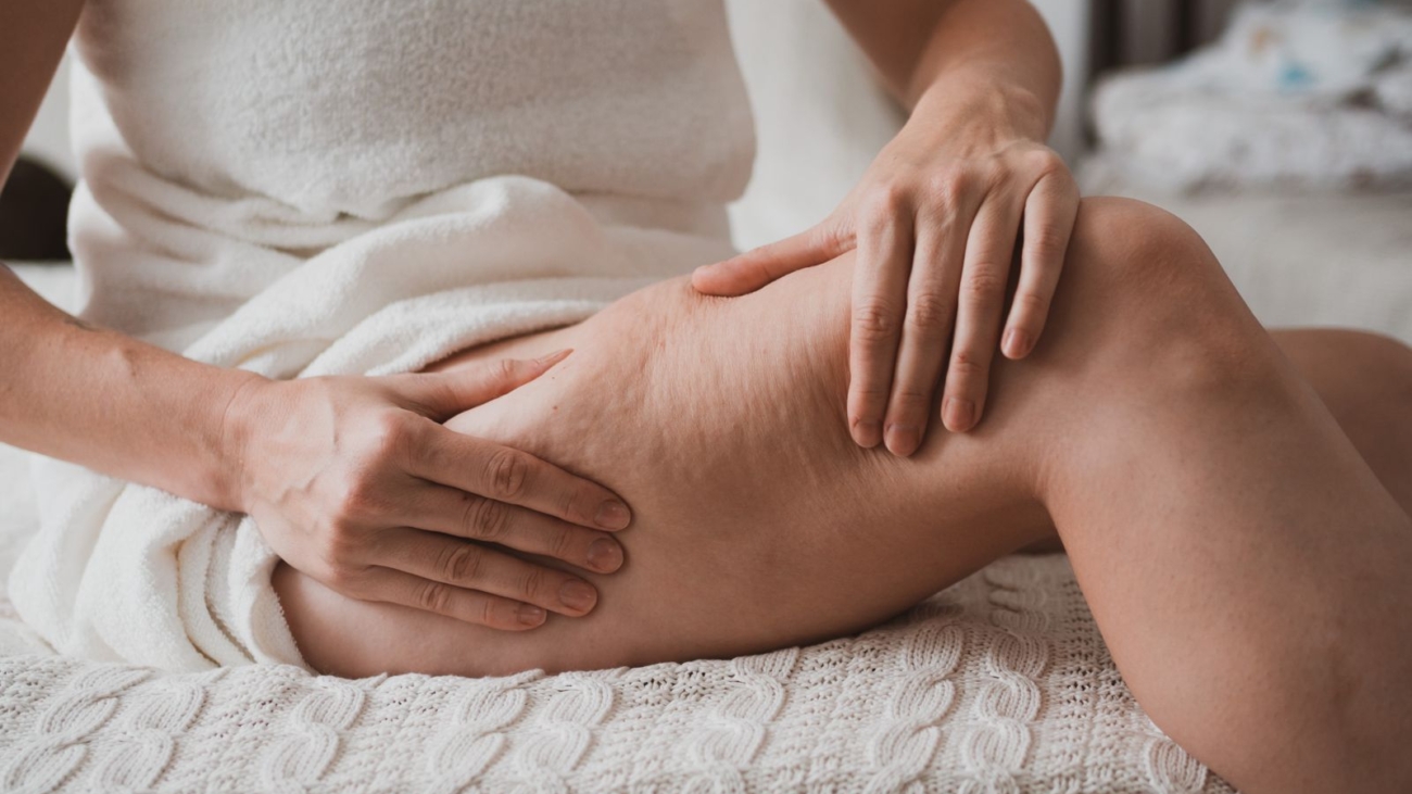Cellutone – A Revolution in Cellulite Reduction and Body Contouring Without Pain or Invasive Procedures
