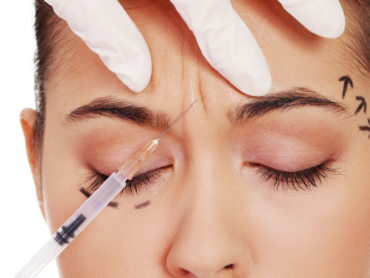 Botox Treatment in Roseville