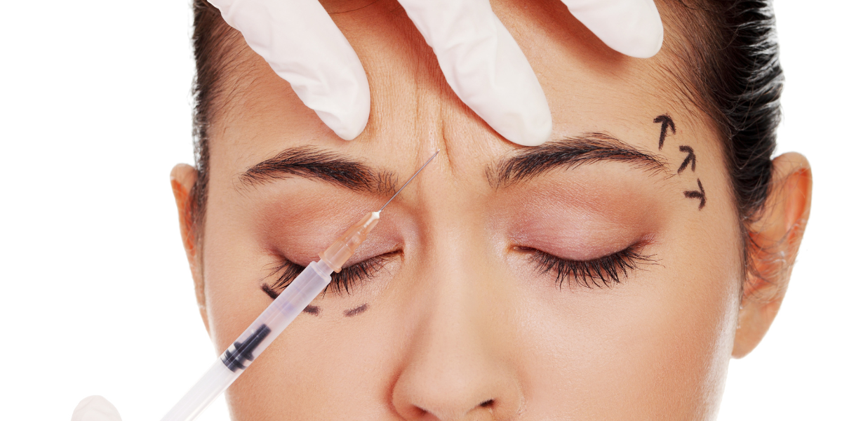 Botox Treatment in Roseville