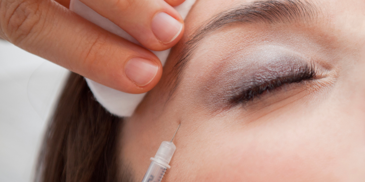 how long does botox last