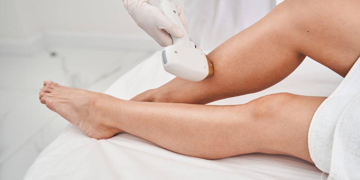 Laser Hair Removal in Roseville California