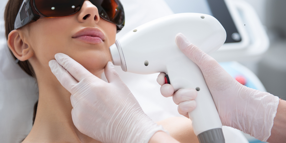 laser hair removal cost