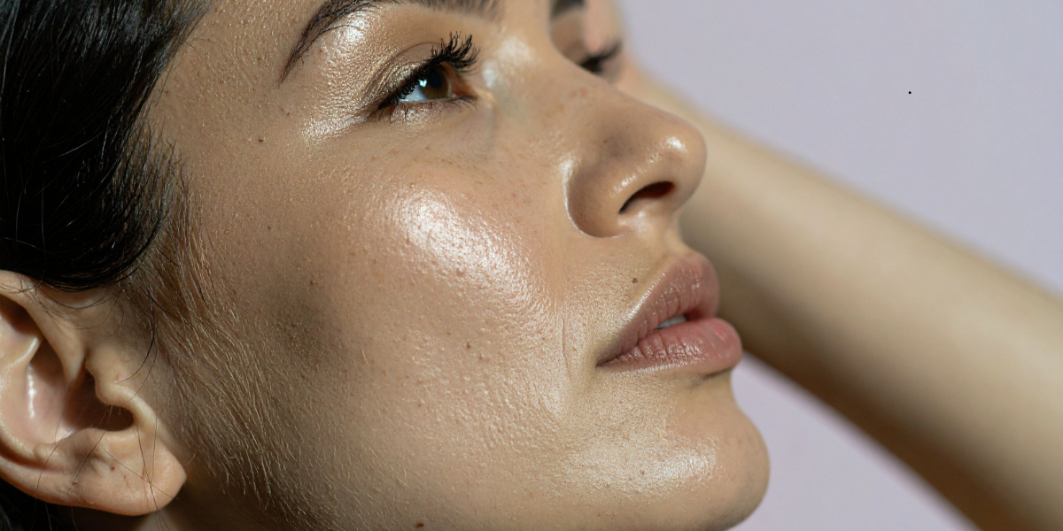 After Treatment and Recovery