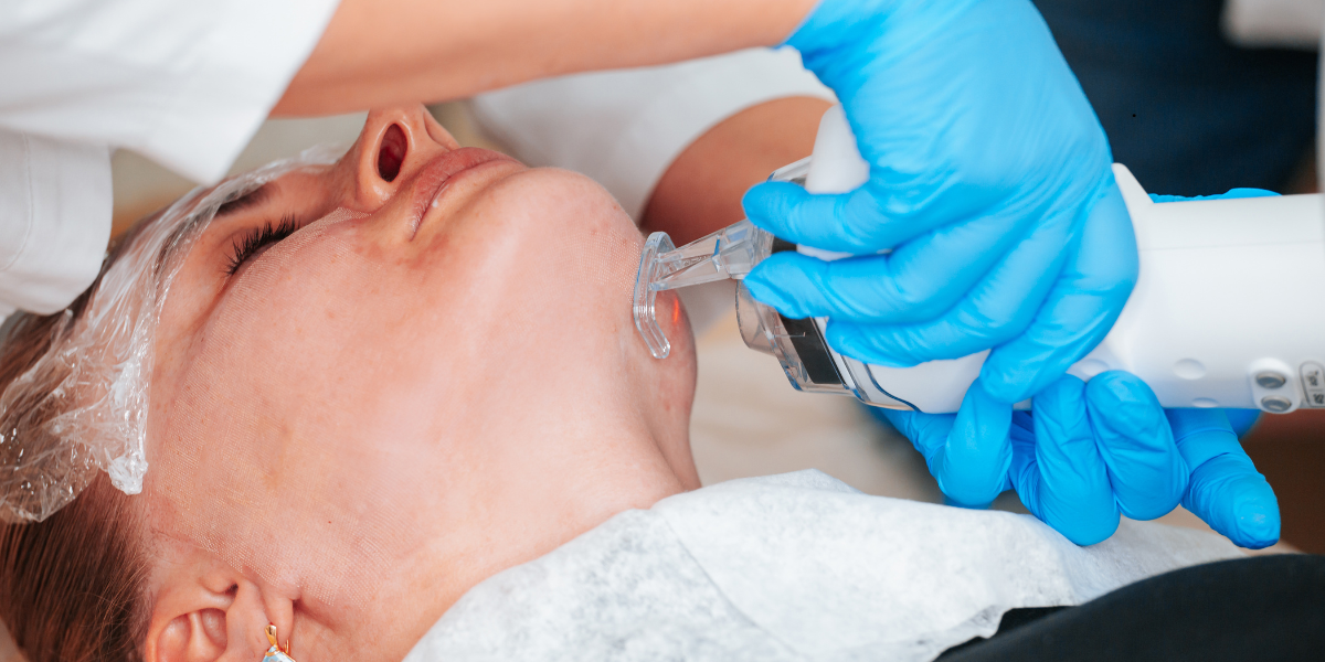 Laser Skin Resurfacing