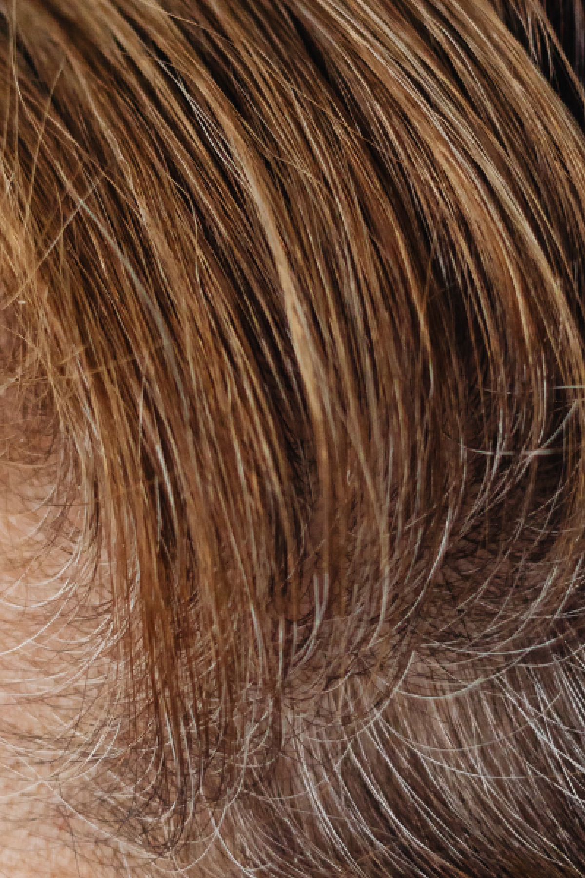 How PRP compares to other hair restoration approaches