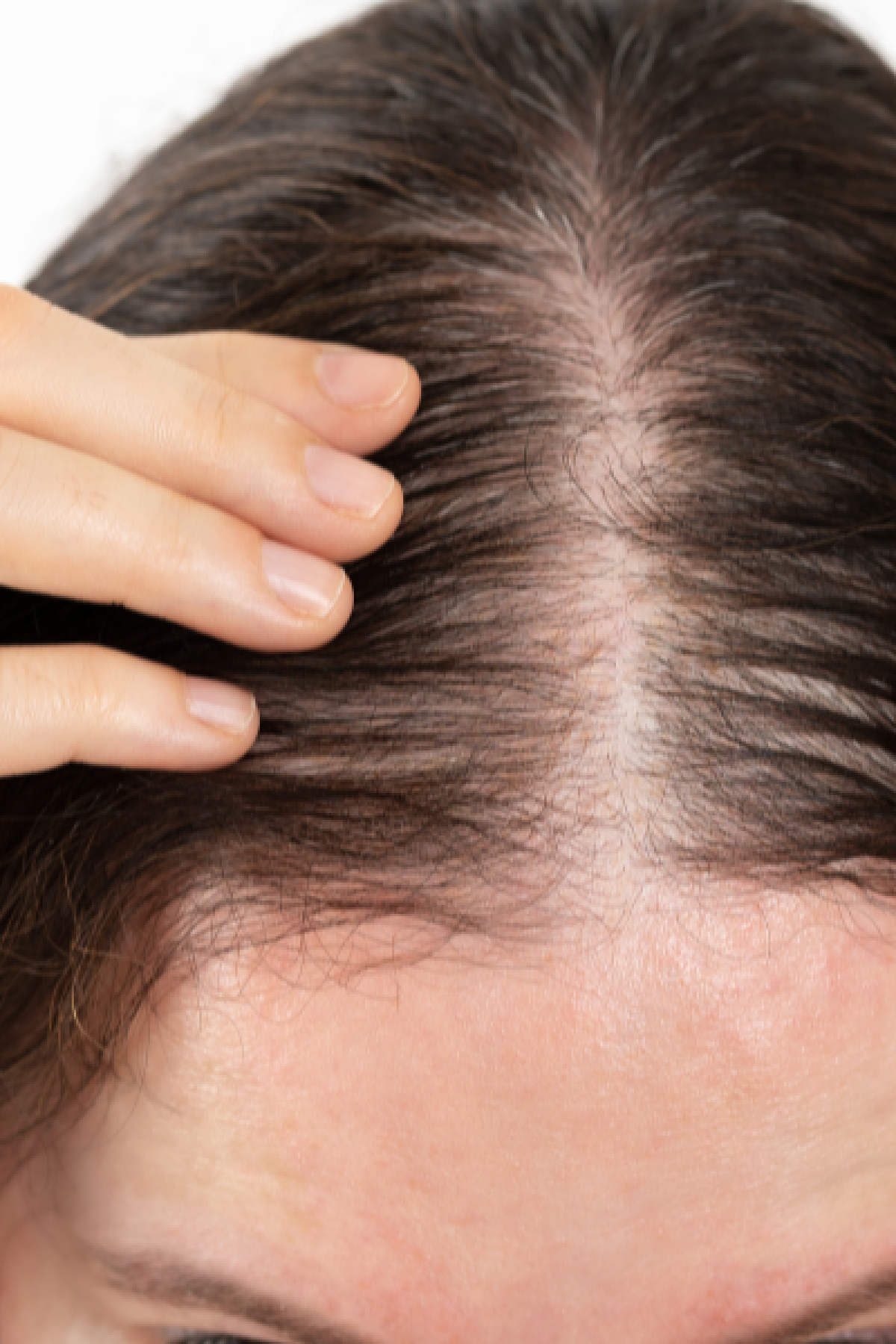 PRP hair restoration at a glance