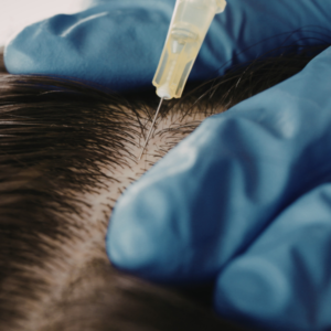 Understanding why hair thins and what can be done about it