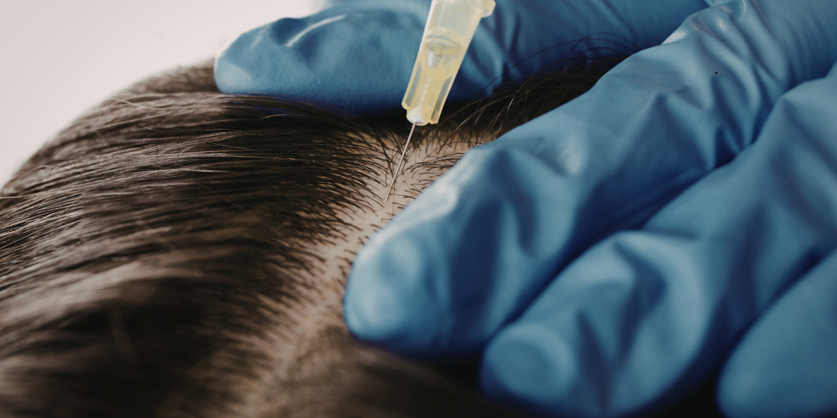 Understanding why hair thins and what can be done about it